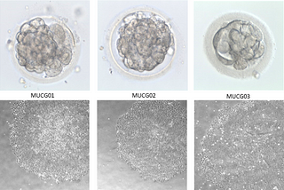 Declaring Embryos ‘People’ Devalues Human Life