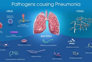 Diagnosing Pneumonia Using Deep Learning