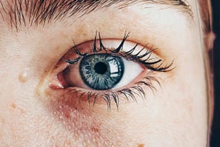 A close-up of a woman’s blue eye and imperfect skin.