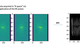 full sample k-space images and reconstructed knee image