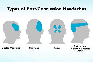 Concussion Headaches or “Post-Traumatic Headaches”: What They Feel Like, How Long They Last, and…