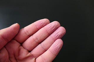 Why Do Fingers and Toes “Prune Up” After Being in Water?