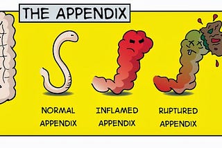 Journal Club: Is the Appendectomy the Next Surgery on the Chopping Block?