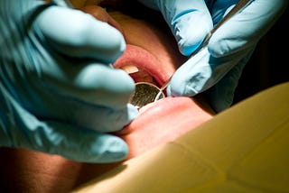 Most Common Dental Problems