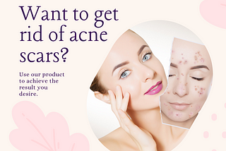 Want to Get Rid of Acne Scars? Here’s What You Need to Know