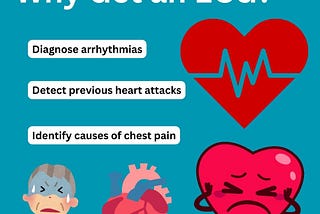 ECG