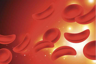 Gene Therapy Researched As Potential Treatment For Sickle Cell Disease