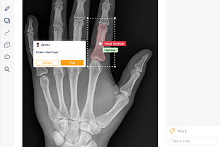 Medical Image Annotation — A UX Case Study