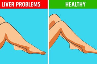 If You Feel These On Your Legs, Your Inner Organs Aren’t Working Properly