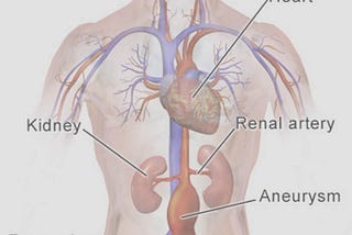 Six Things You Should Know about Ambulatory Phlebectomy?