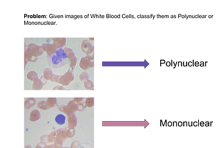 Classifying White Blood Cells With Deep Learning (Code and data included!)