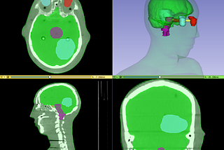 Best medical annotation tools for Healthcare AI