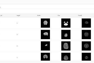 Kaggle’s  Brain Tumor Detection Competition Using  Google Colab and Google Drive