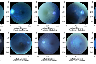 Ocular Disease Recognition using CNNs.
