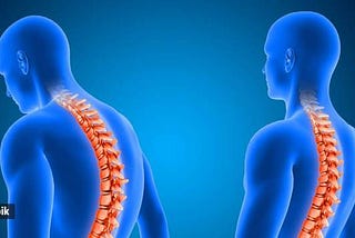 SPINAL SURGERY BY DR. KAUSHAL KANT MISHRA