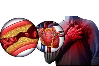 Doctor’s advice: There are many problems behind shoulder pain