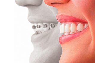 Cosmetic Dentistry Treatment options to recover beautiful smile