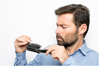 Hair Loss in Men: Conquering Hair Loss by Understanding Male Pattern Baldness