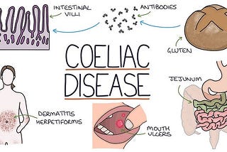 Symptoms and prevention of celiac disease