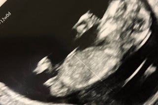 Reflections on a (first) first trimester