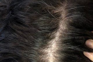 A close-up on the part of the author’s hair. They have a white scalp and dark brown hair, with a significant number of grey roots coming through.