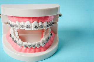 Braces Boca Raton