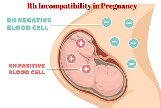 RHESUS FACTOR INCOMPATIBILITY