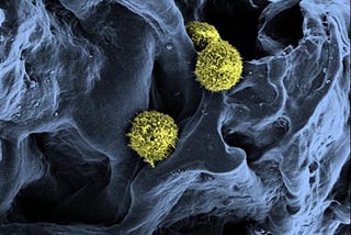 CRISPR Meets Stem Cells: Curing Sickle Cell Diseases