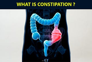 Constipation treatment in homoeopathic