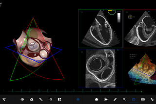 CAE Vimedix: 3 Ultrasound Simulator Configurations on Just 1 Platform