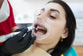 How Long Do Results from Cosmetic Dentistry Last?