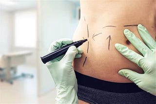 Liposuction Surgery — Know the Treatment Methods and How to Find the Right one