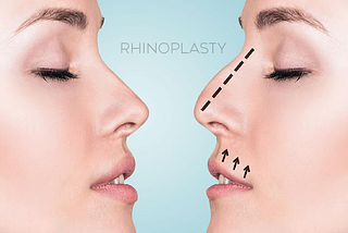 About Rhinoplasty