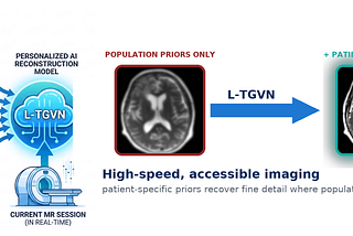 Infographic showing past scans and medical records flowing into an L-TGVN AI model alongside a current MRI session, leading to faster reconstruction and a clearer brain MRI.