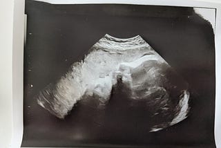 One Hundred Percent (Still) Pregnant