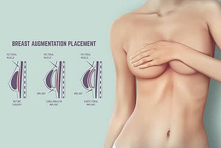 breast augmentation surgery in gurgaon