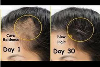 Doctor Develops Insane Remedy For Hair Loss