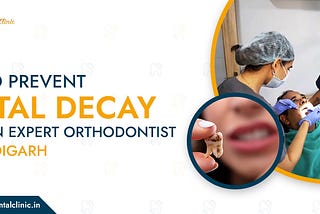 How to Prevent Dental Decay As Per an expert Orthodontist in Chandigarh