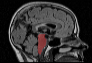 Part 1: Python and DICOM: Two easy tools to save time and energy when working with medical images…