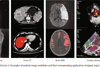 Advances in Deep Learning-Based Medical Image Analysis