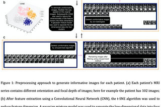 Figure 1: Preprocessing approach to generate informative images for each patient. (a) Each patient’s MRI series contains diff