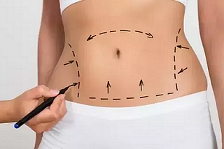 Reduce Fat With Laser Lipo Whittier