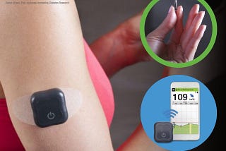Could Implantable Glucose Sensors be a Viable Option for Monitoring Blood Sugar?