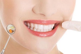 Teeth whitening Frequently Asked Questions