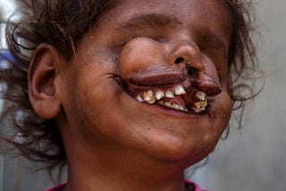 Look Away If You Dare