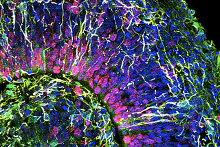 No Two Brains Are the Same: How Neuroscience Is Advancing to Account for This