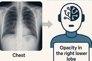 Fine-Tuning MedGemma-4B-IT on Chest X-Rays (ReXGradient) for Under $5: A Lite Evaluation Experiment
