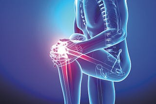 What is Orthopedics and What Do Orthopedists Do