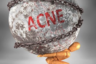 How to Get Rid of Acne and Pimples