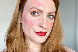 “When I stopped seeing my skin as my enemy, it changed my perspective”